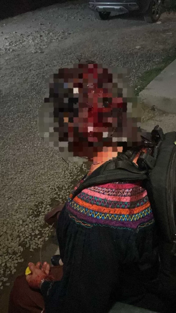 En San Francisco Totimehuacan, una mujer fue golpeada en un asalto.  