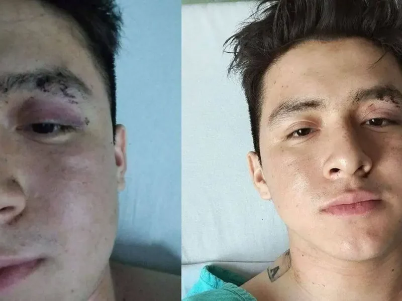 Pareja es atacada con un cuchillo en el Parque Ecológico 