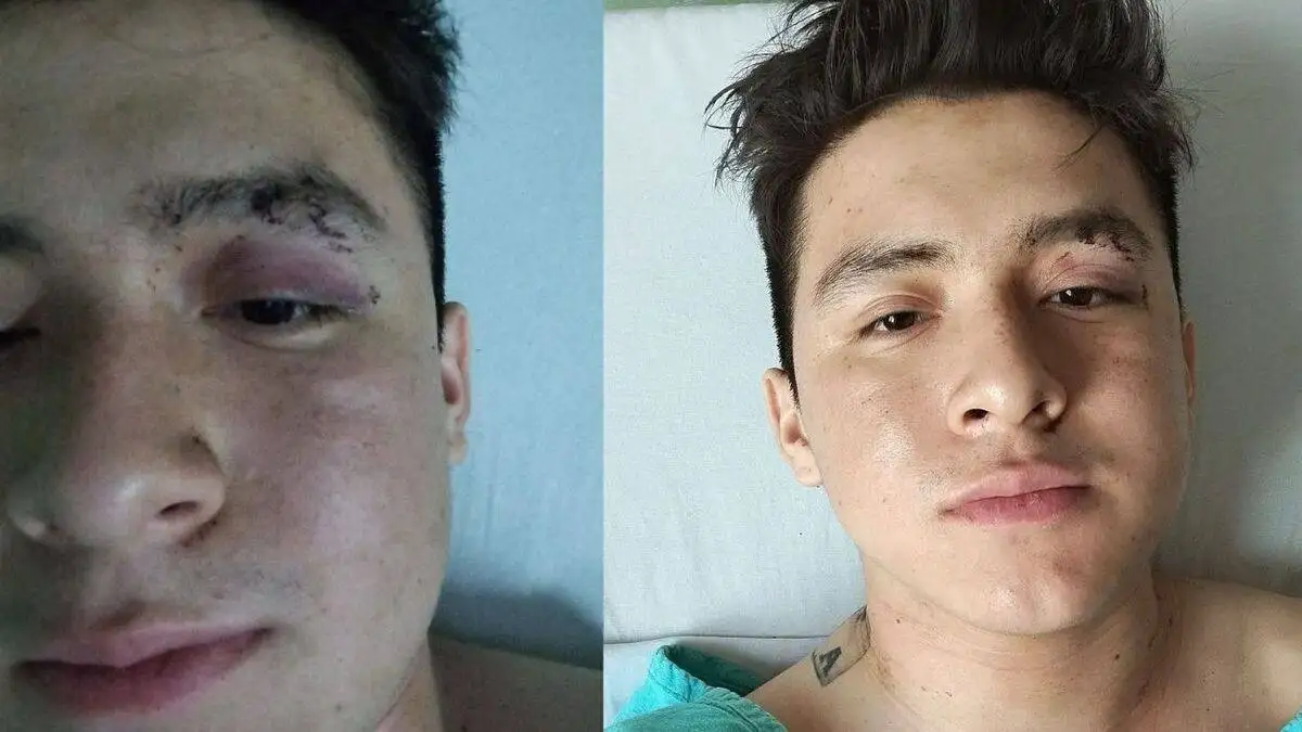 Pareja es atacada con un cuchillo en el Parque Ecológico 