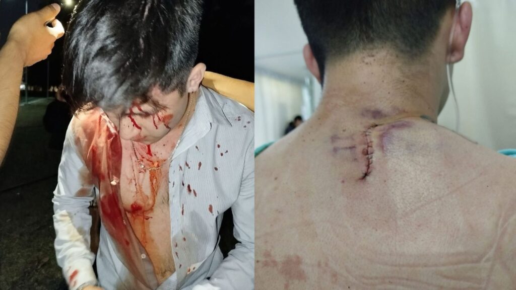 Tras resultar herido, Alexis logró levantarse y huir con su novia.