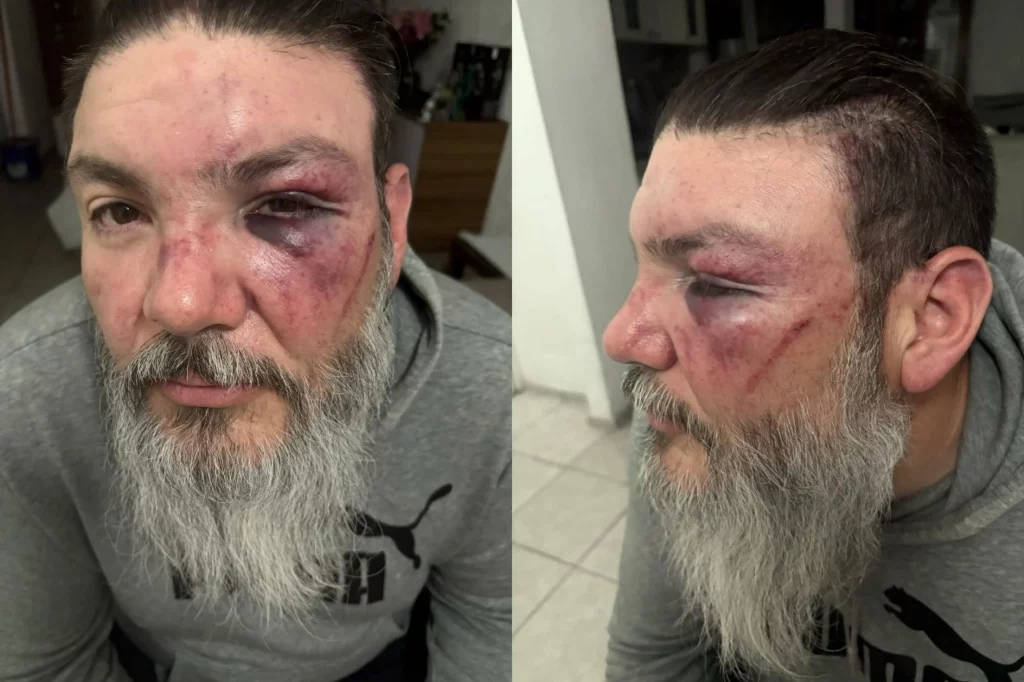 El conductor de televisión Fher Jara, conocido por su trabajo al frente del programa poblano de rock “El Fusil”, fue agredido al salir del Estadio Cuauhtémoc después del partido Cruz Azul contra los Pumas.