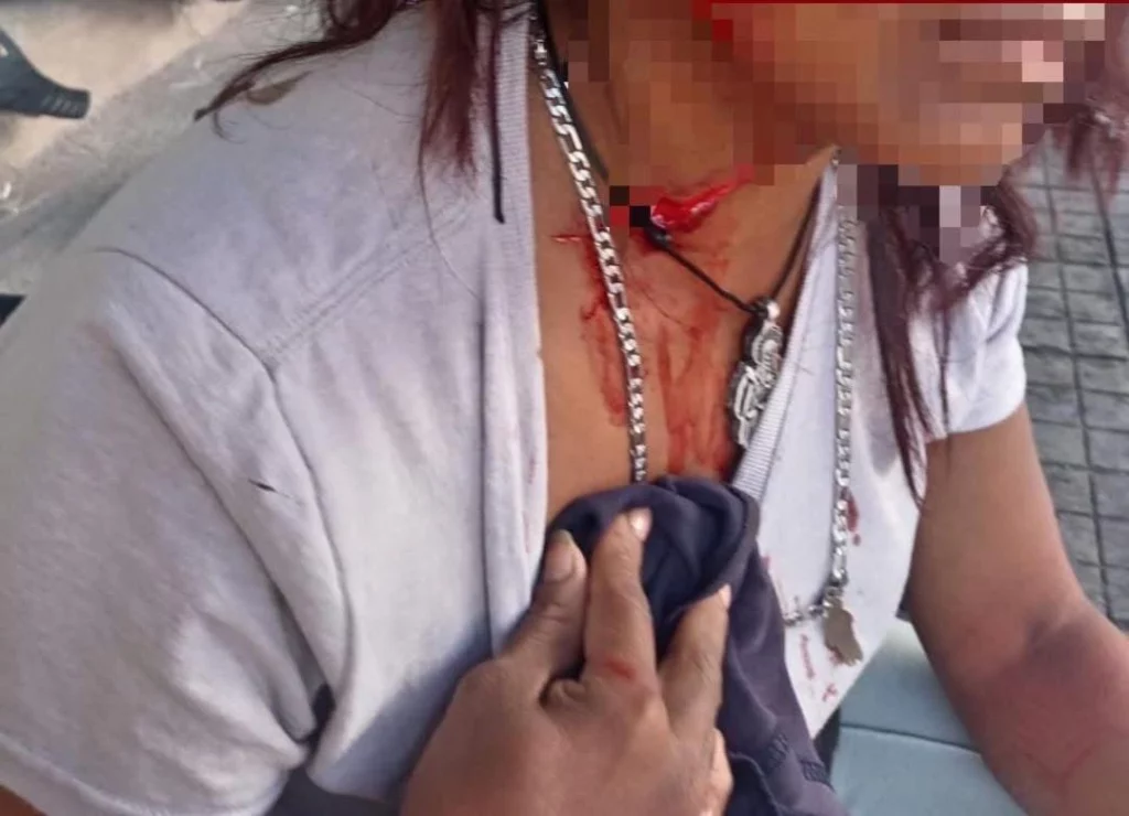 La tarde del martes 28 de octubre un limpiaparabrisas fue detenido por apuñalar en varias ocasiones a su pareja sentimental en el municipio de Tehuacán, Puebla.