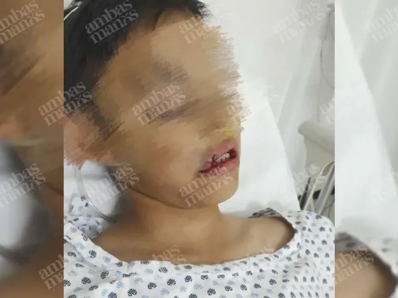 Acusan negligencia en el Colegio Juventus de Puebla; niño se destrozó el labio
