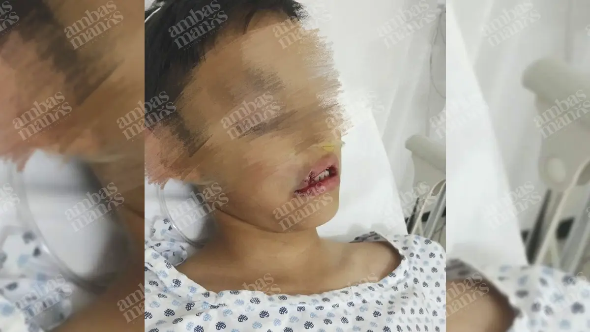 Acusan negligencia en el Colegio Juventus de Puebla; niño se destrozó el labio