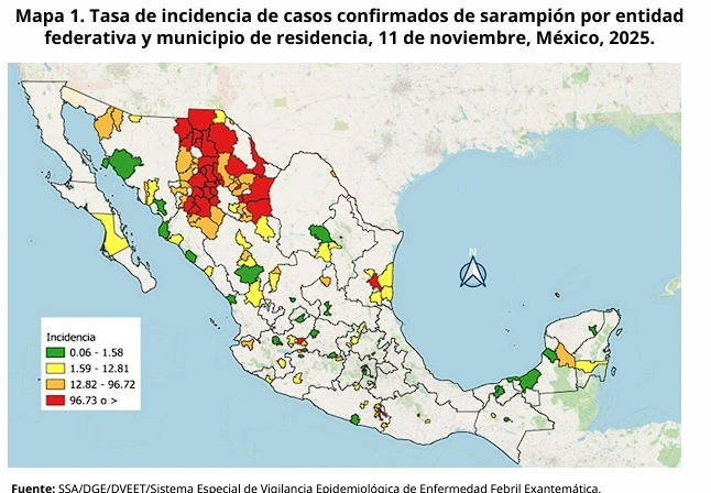Hasta el 11 de noviembre, no hubo casos de sarampión en Puebla.