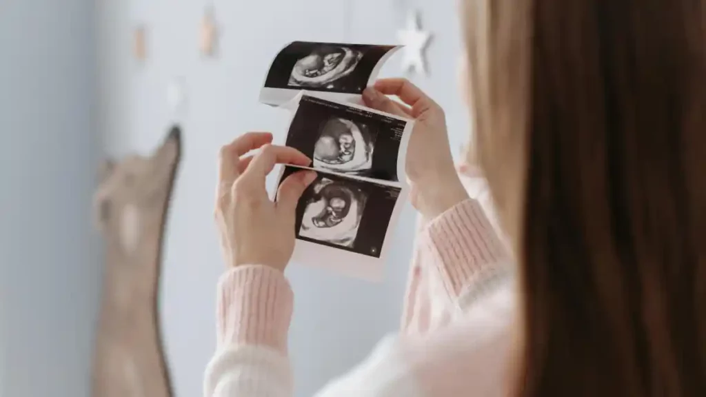 Mujer sosteniendo tres fotos de un ultrasonido.