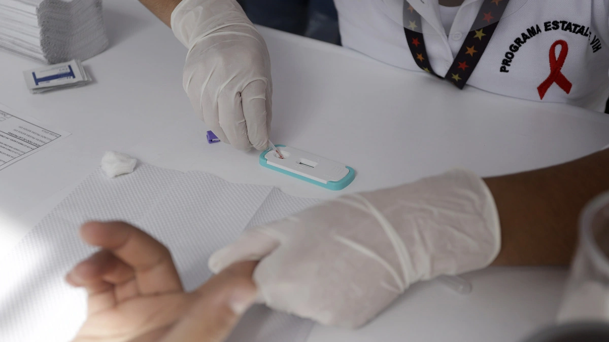 Aumentan 27% las muertes por VIH en Puebla  