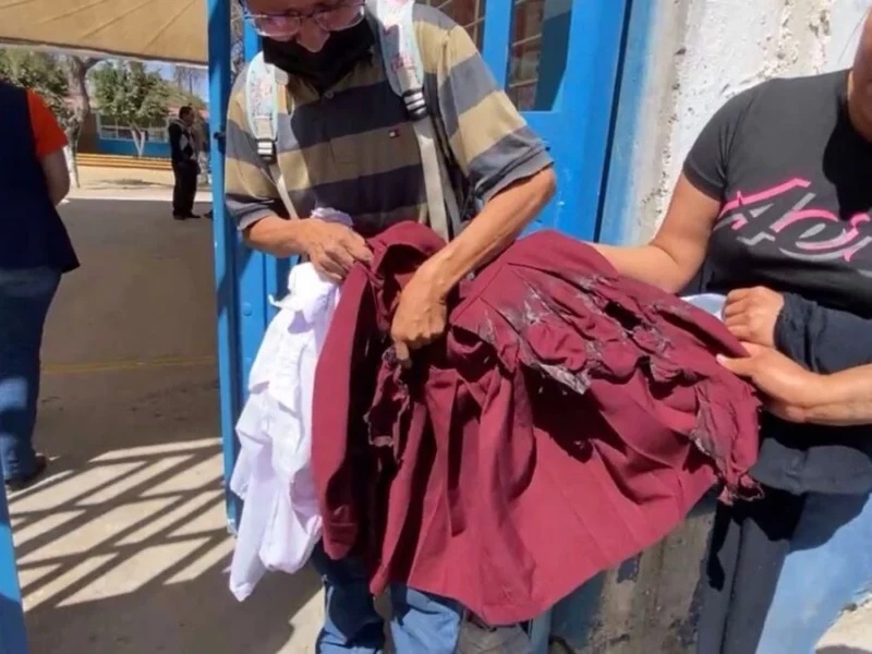 Alumna de primaria en Tehuacán sufre graves quemaduras tras un experimento  