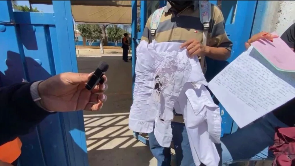 La alumna en Tehuacán terminó con quemaduras de segundo grado. 