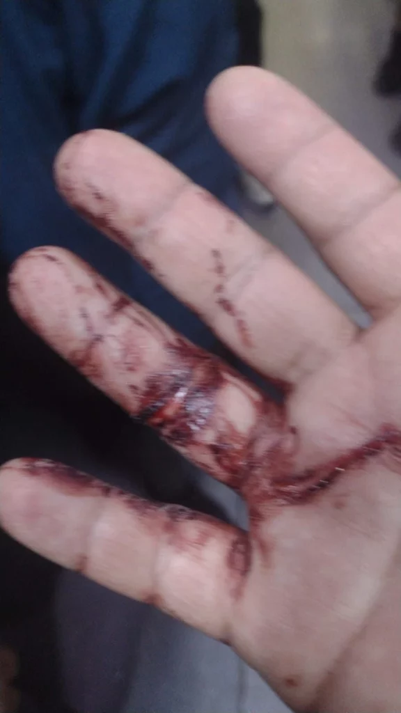 Fue el sábado cuando atacaron con una navaja a un hombre en el Paseo Bravo.