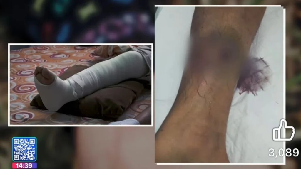 La bala perdida en la Vía Atlixcáyotl afectó la tibia del repartidor.