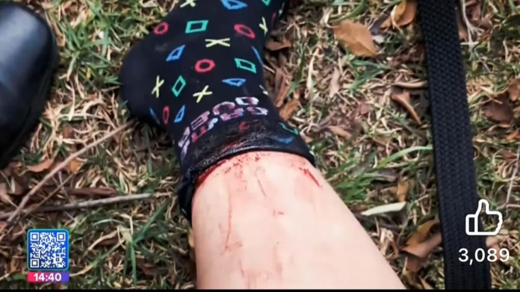 El repartidor herido por una bala perdida en la Vía Atlixcáyotl tiene 24 años.