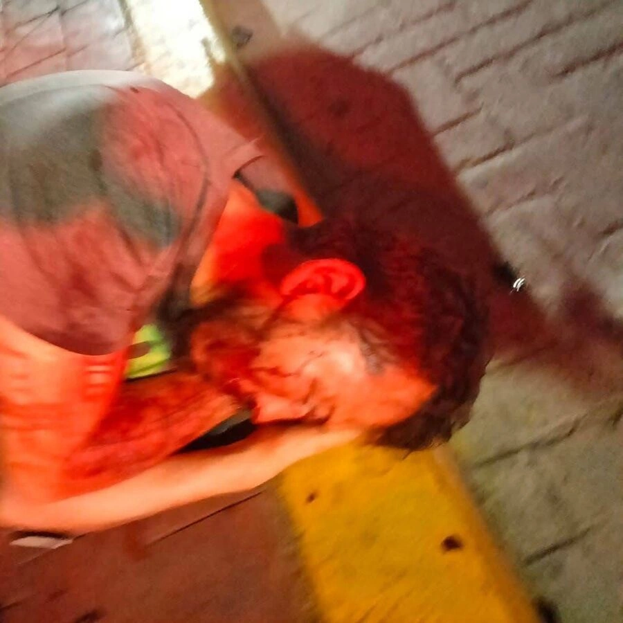 La riña entre borracho en San Andrés Cholula dejó un hombre herido.