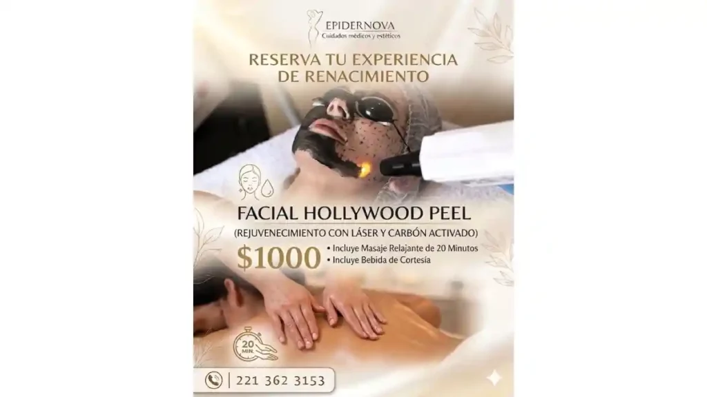 Facial Hollywood Peel en Epidernova.
