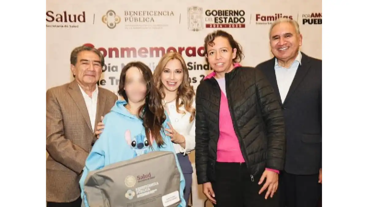 SEDIF y Beneficencia Pública Nacional transforman vidas de niñas y niños con Síndrome de Treacher Collins