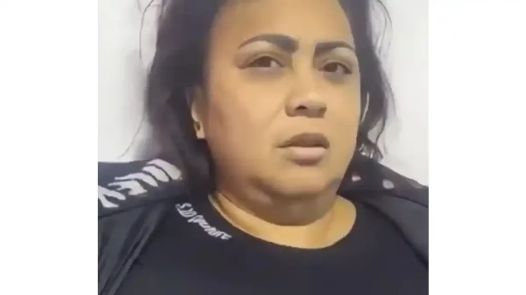 Yalixa Toloza después de que le practicaran el procedimiento estético en Beauty Láser en Bogotá.