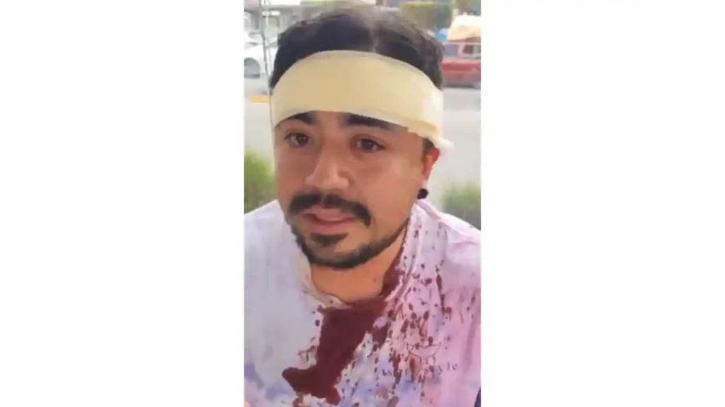 Eder, el joven que denunció a carteristas y lo golpearon en un paradero de la línea 3 del RUTA Puebla.